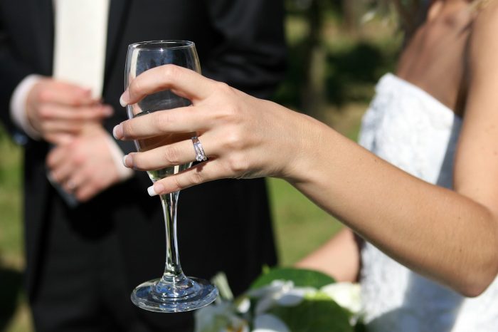 "Sì lo voglio": sempre più sposi ricorrono alla chirurgia prima del matrimonio