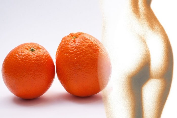 Cellulite e Gambe pesanti? Scopri la linea Natural Benex di Erboristeria Magentina